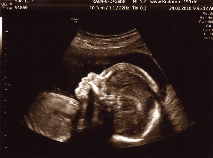 Ultraschall_100224_2